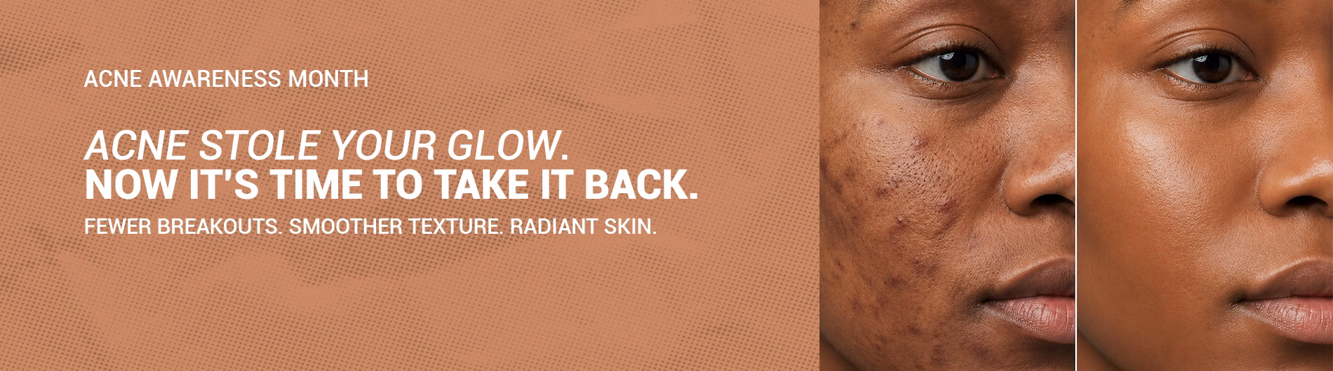 Bio Oil